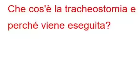 Che cos'è la tracheostomia e perché viene eseguita?