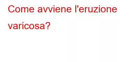 Come avviene l'eruzione varicosa