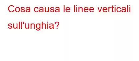 Cosa causa le linee verticali sull'unghia