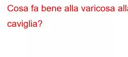 Cosa fa bene alla varicosa alla caviglia?