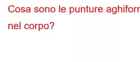 Cosa sono le punture aghiformi nel corpo?