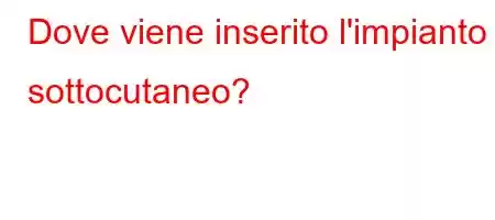 Dove viene inserito l'impianto sottocutaneo?