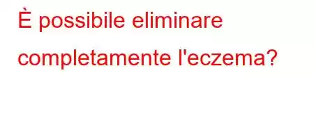 È possibile eliminare completamente l'eczema?