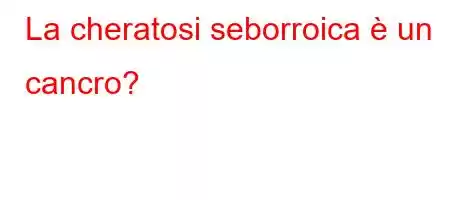 La cheratosi seborroica è un cancro?